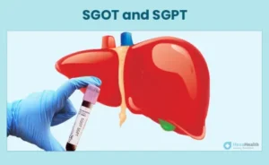 SGPT test showing liver health results in a medical laboratory